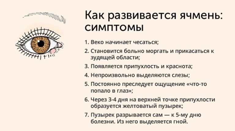 Как избавиться от ячменя быстро. Ячмень обрабатывают настойкой из цветков календулы. Применение сухого тепла.