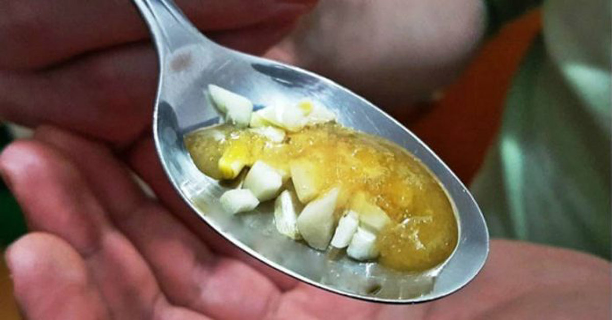 Чесночная настойка для здоровья и омоложения организма. Чесночная настойка чистит сосуды.
