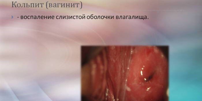 Тержинан действие. Передозировка и побочные эффекты. Противопоказания к назначению Тержинана.