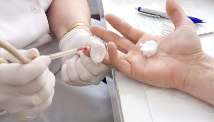 Что делать, если простудил глаз – симптомы и лечение. Продуло глаз: симптомы, особенности лечения.